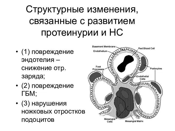 Структурные изменения, связанные с развитием протеинурии и НС (1) повреждение эндотелия