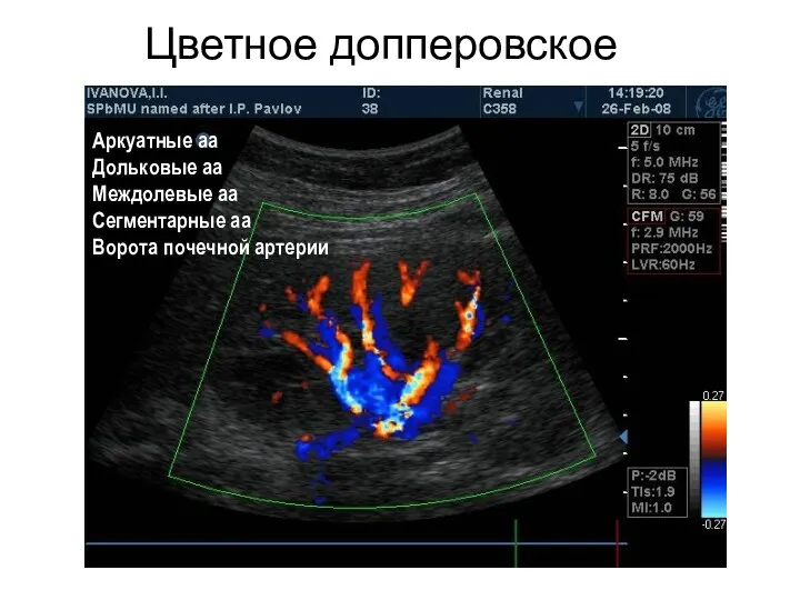 Цветное допперовское картирование Аркуатные аа Дольковые аа Междолевые аа Сегментарные аа Ворота почечной артерии