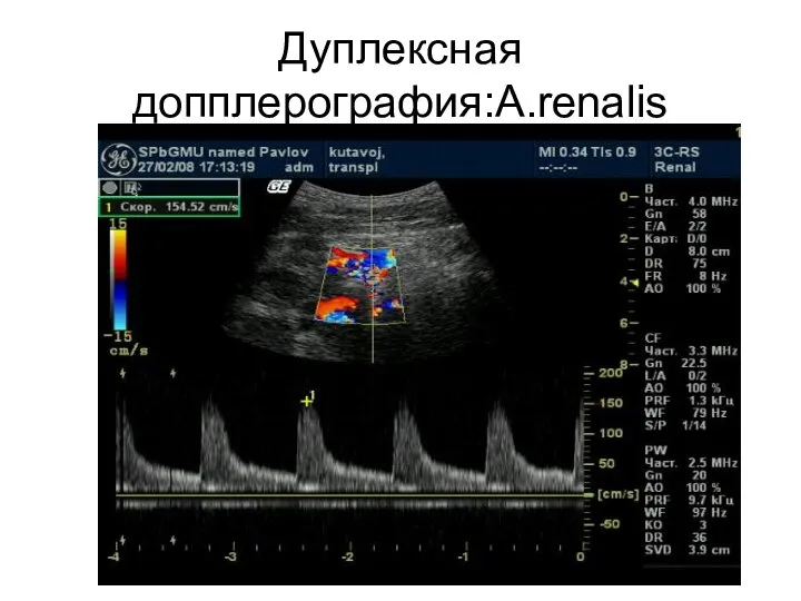 Дуплексная допплерография:A.renalis