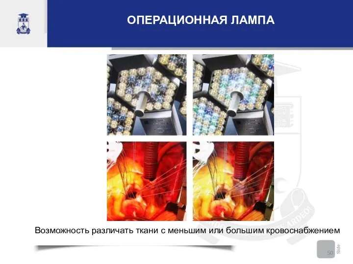 Возможность различать ткани с меньшим или большим кровоснабжением ОПЕРАЦИОННАЯ ЛАМПА