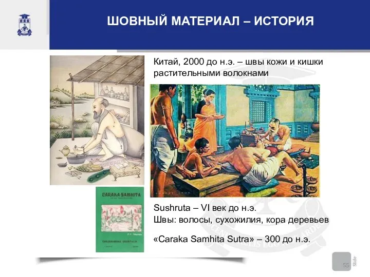 ШОВНЫЙ МАТЕРИАЛ – ИСТОРИЯ Китай, 2000 до н.э. – швы кожи