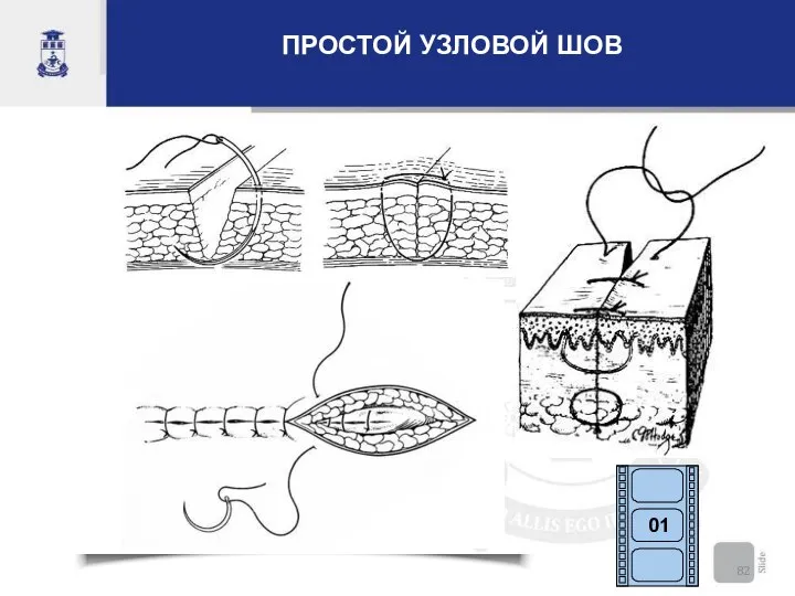 ПРОСТОЙ УЗЛОВОЙ ШОВ 01