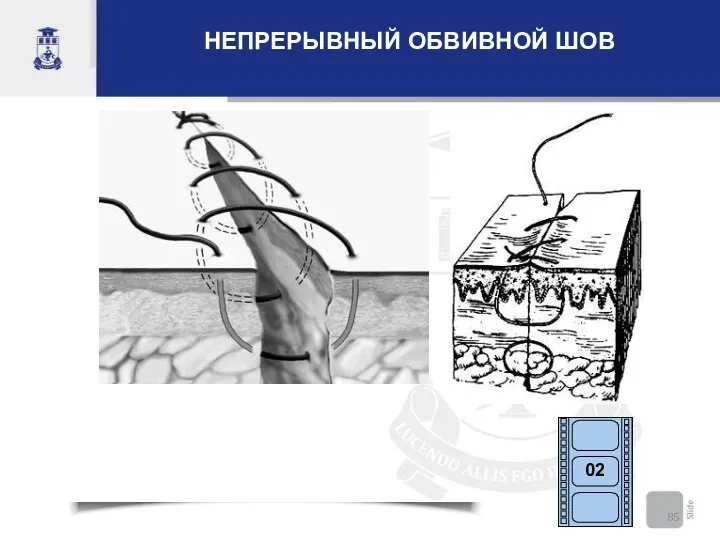 НЕПРЕРЫВНЫЙ ОБВИВНОЙ ШОВ 02