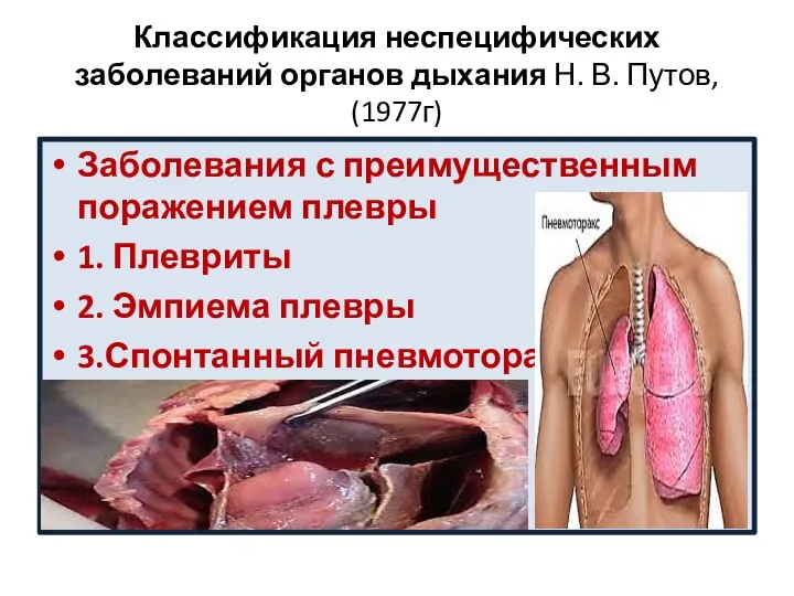 Классификация неспецифических заболеваний органов дыхания Н. В. Путов, (1977г) Заболевания с