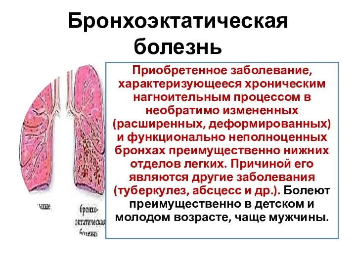 Бронхоэктатическая болезнь