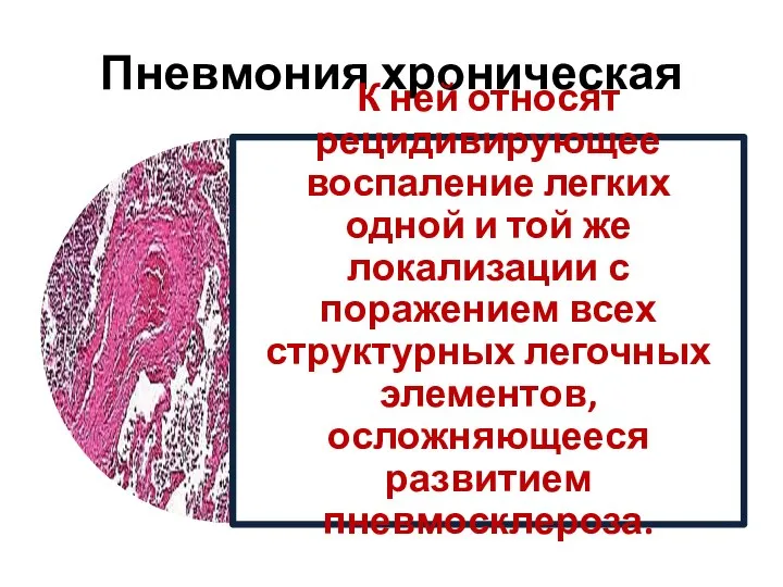 Пневмония хроническая