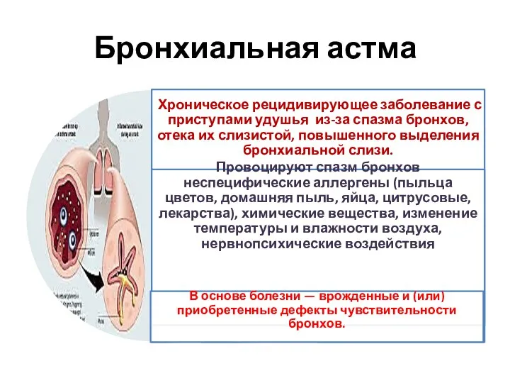 Бронхиальная астма