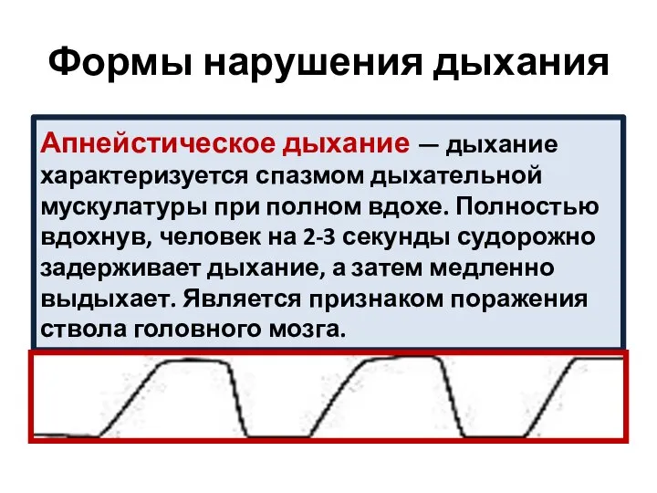 Формы нарушения дыхания Апнейстическое дыхание — дыхание характеризуется спазмом дыхательной мускулатуры