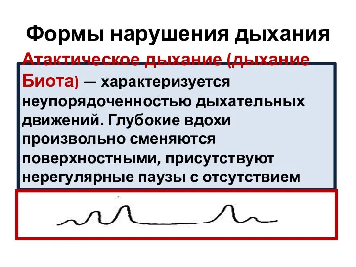 Формы нарушения дыхания Атактическое дыхание (дыхание Биота) — характеризуется неупорядоченностью дыхательных