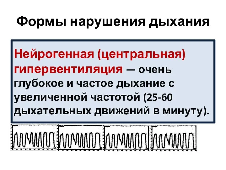 Формы нарушения дыхания Нейрогенная (центральная) гипервентиляция — очень глубокое и частое