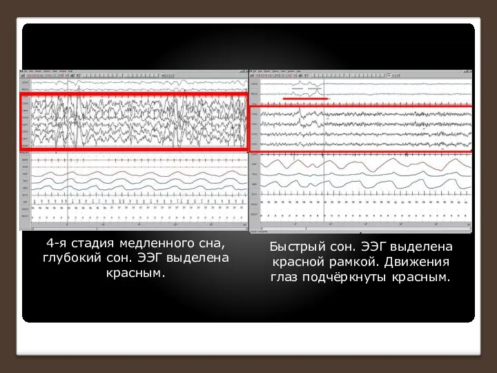 4-я стадия медленного сна, глубокий сон. ЭЭГ выделена красным. Быстрый сон.