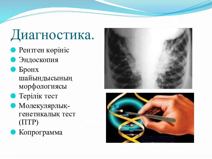 Диагностика. Рентген көрініс Эндоскопия Бронх шайындысының морфологиясы Терілік тест Молекулярлық-генетикалық тест(ПТР) Копрограмма