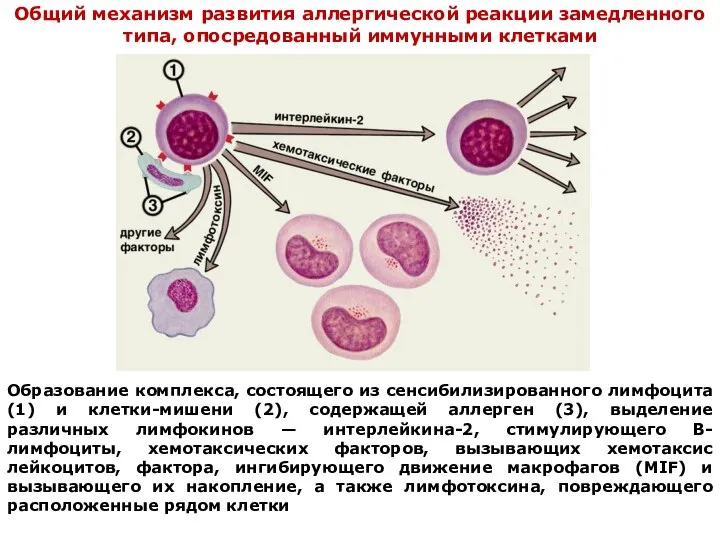 Образование комплекса, состоящего из сенсибилизированного лимфоцита (1) и клетки-мишени (2), содержащей