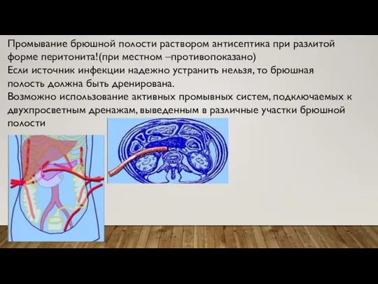 Промывание брюшной полости раствором антисептика при разлитой форме перитонита!(при местном –противопоказано)