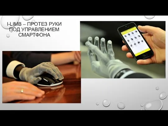 I-LIMB – ПРОТЕЗ РУКИ ПОД УПРАВЛЕНИЕМ СМАРТФОНА