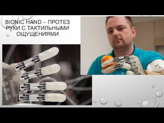 BIONIC HAND – ПРОТЕЗ РУКИ С ТАКТИЛЬНЫМИ ОЩУЩЕНИЯМИ