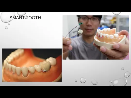 SMART TOOTH