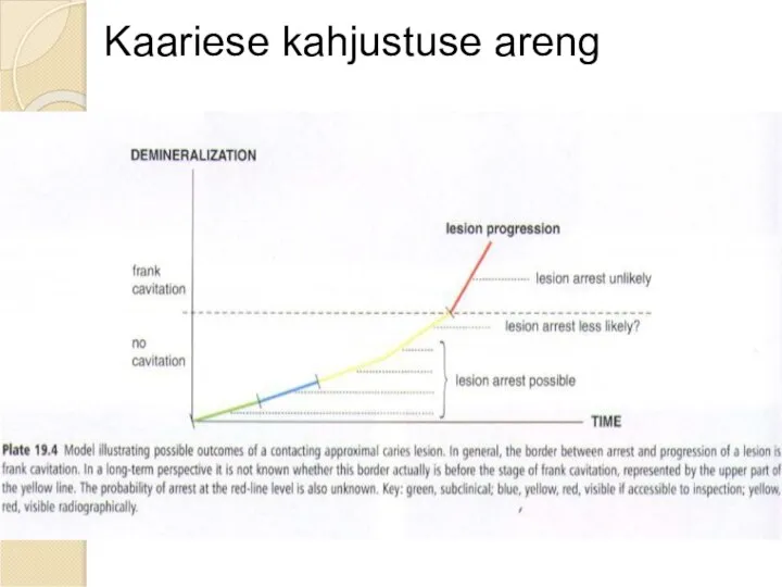 Kaariese kahjustuse areng