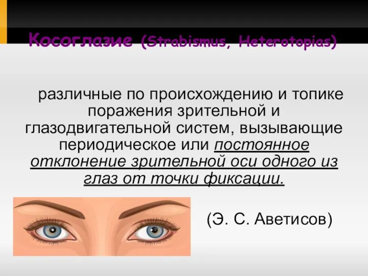 Косоглазие (Strabismus, Heterotopias) различные по происхождению и топике поражения зрительной и