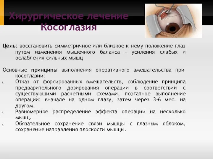 Цель: восстановить симметричное или близкое к нему положение глаз путем изменения