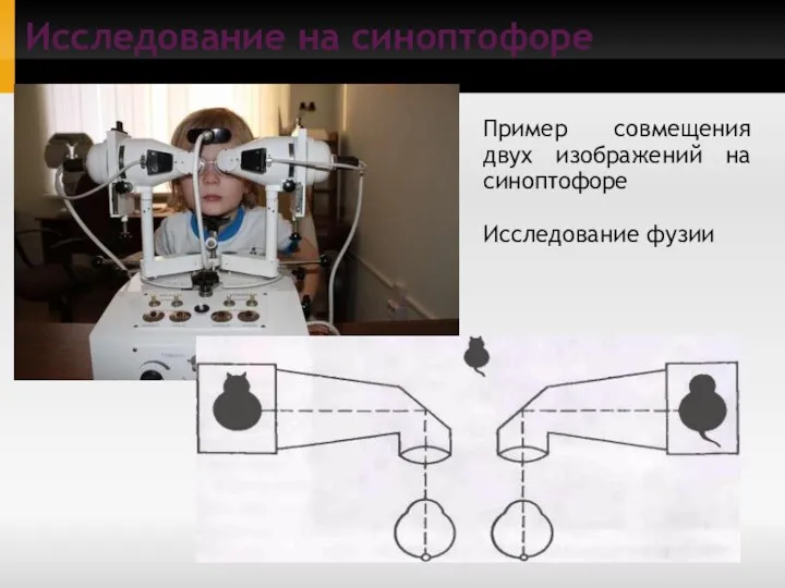 Пример совмещения двух изображений на синоптофоре Исследование фузии Исследование на синоптофоре