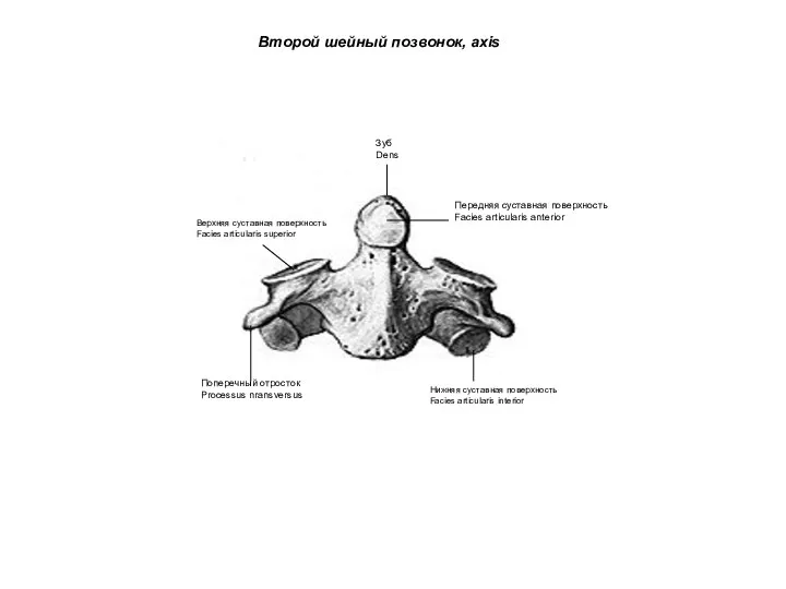 Второй шейный позвонок, axis Зуб Dens Передняя суставная поверхность Facies articularis