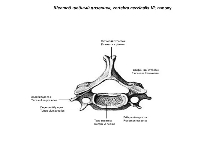 Шестой шейный позвонок, vertebra cervicalis VI; сверху Тело позвонка Corpus vertebrae