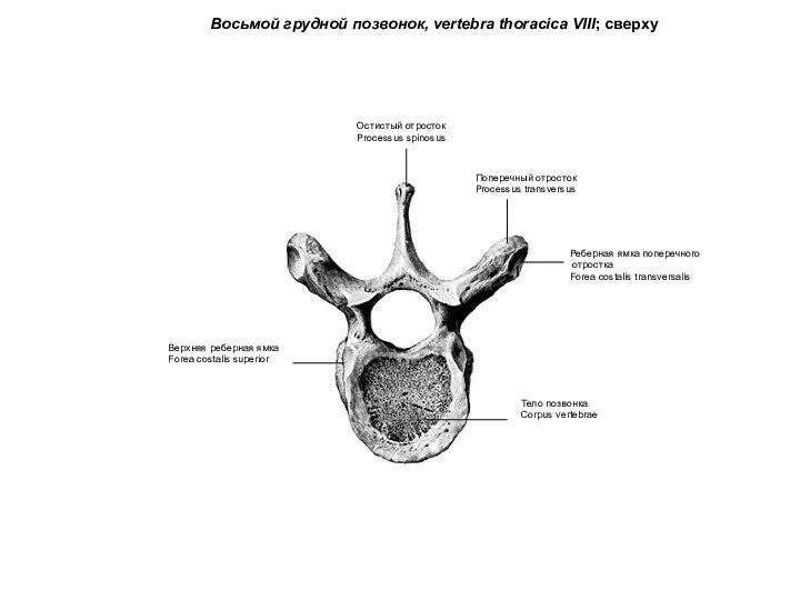 Восьмой грудной позвонок, vertebra thoracica VIII; сверху Поперечный отросток Processus transversus