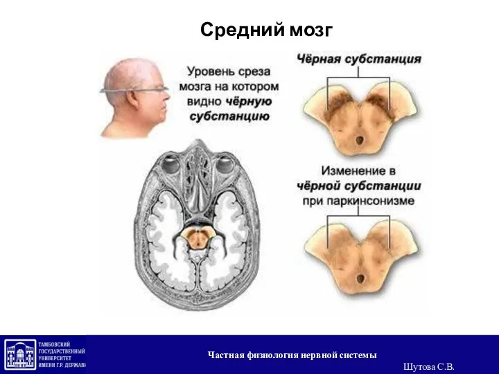 Средний мозг Частная физиология нервной системы Шутова С.В.