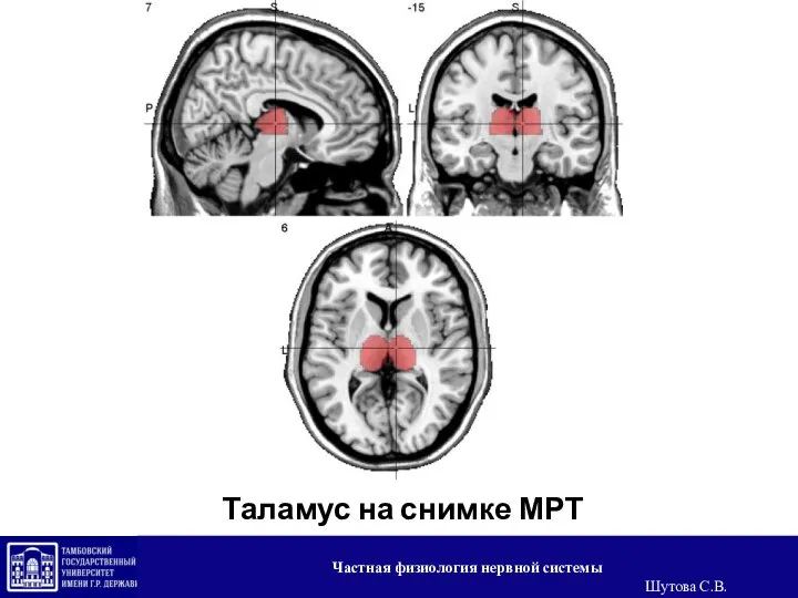 Таламус на снимке МРТ Частная физиология нервной системы Шутова С.В.