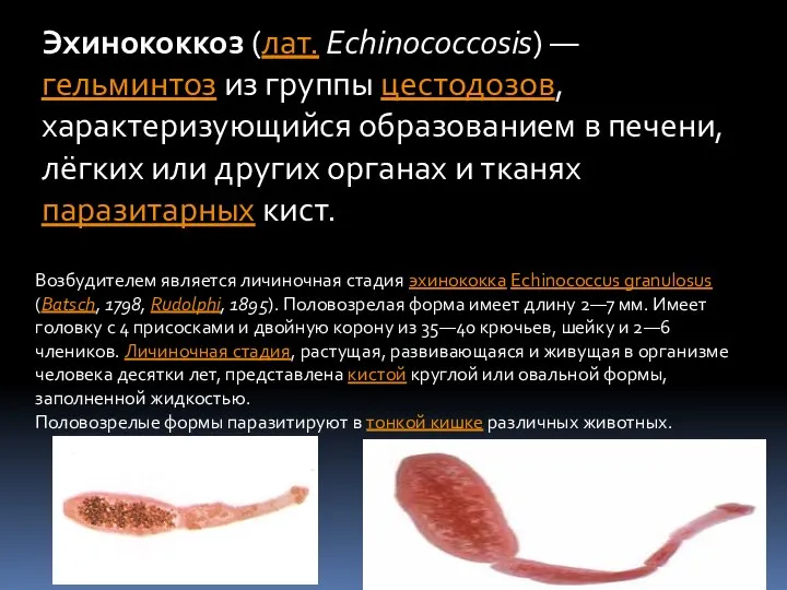 Эхинококкоз (лат. Echinococcosis) — гельминтоз из группы цестодозов, характеризующийся образованием в