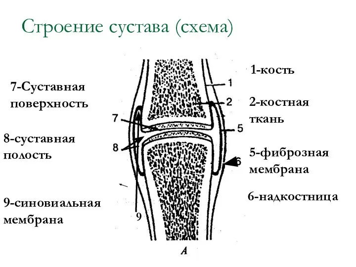 Строение сустава (схема) 1-кость 2-костная ткань 5-фиброзная мембрана 6-надкостница 9 7-Суставная поверхность 8-суставная полость 9-синовиальная мембрана