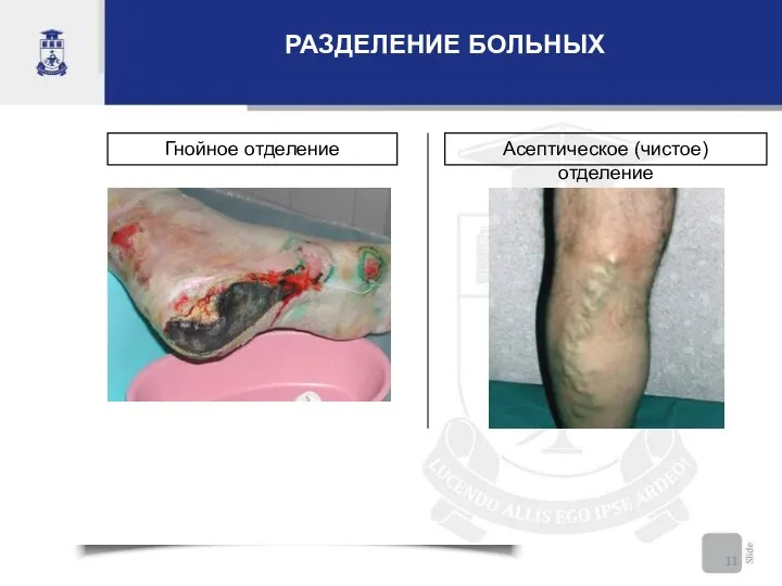 РАЗДЕЛЕНИЕ БОЛЬНЫХ Гнойное отделение Асептическое (чистое) отделение