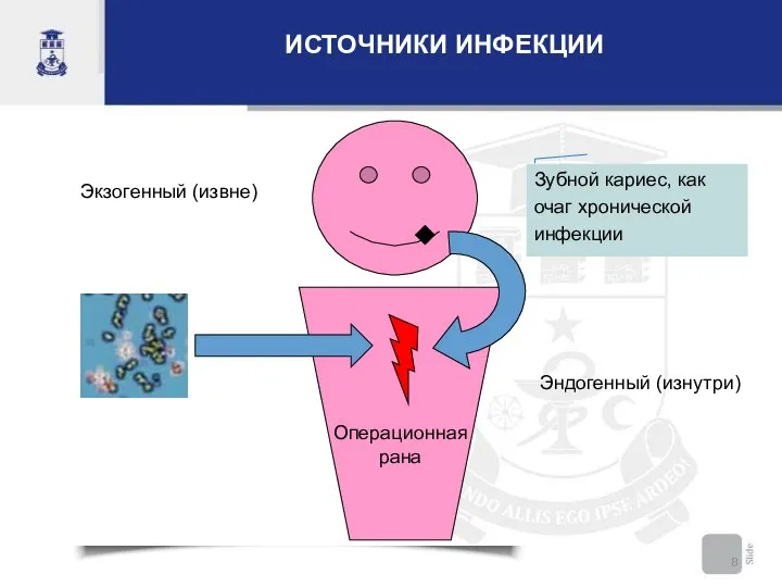 ИСТОЧНИКИ ИНФЕКЦИИ Зубной кариес, как очаг хронической инфекции Операционная рана Экзогенный (извне) Эндогенный (изнутри)