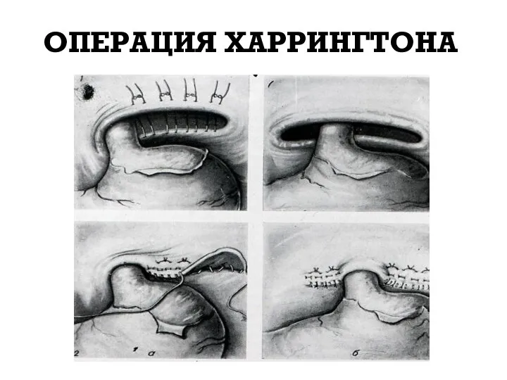 ОПЕРАЦИЯ ХАРРИНГТОНА