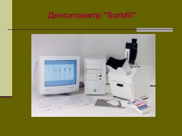 Денситометр "Sorbfil"