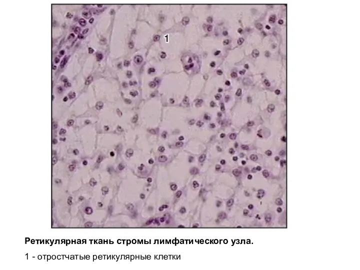 Ретикулярная ткань стромы лимфатического узла. 1 - отростчатые ретикулярные клетки