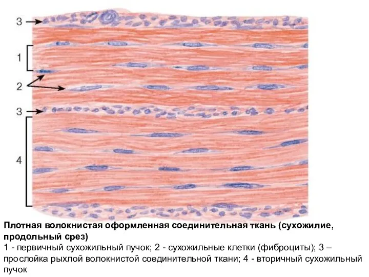 Плотная волокнистая оформленная соединительная ткань (сухожилие, продольный срез) 1 - первичный