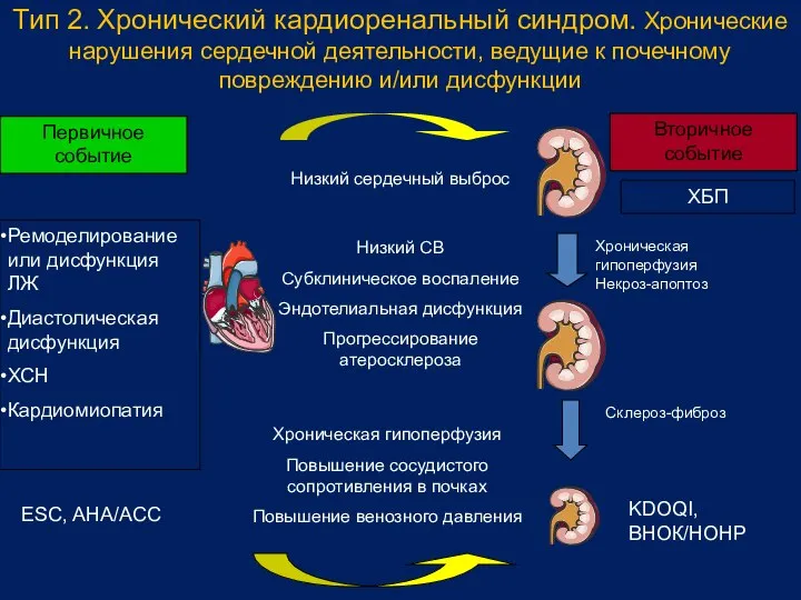 Тип 2. Хронический кардиоренальный синдром. Хронические нарушения сердечной деятельности, ведущие к