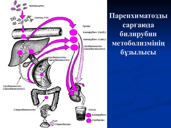 Паренхиматозды сарғаюда билирубин метоболизмінің бұзылысы