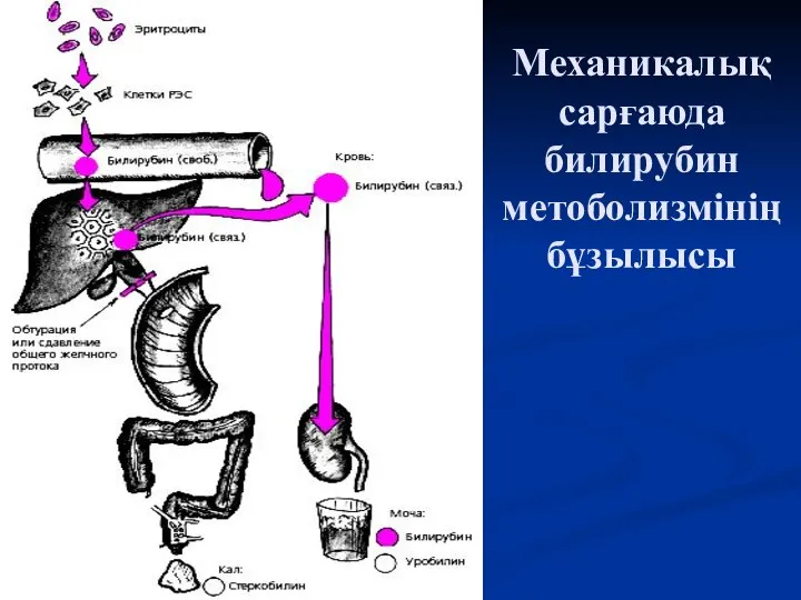 Механикалық сарғаюда билирубин метоболизмінің бұзылысы