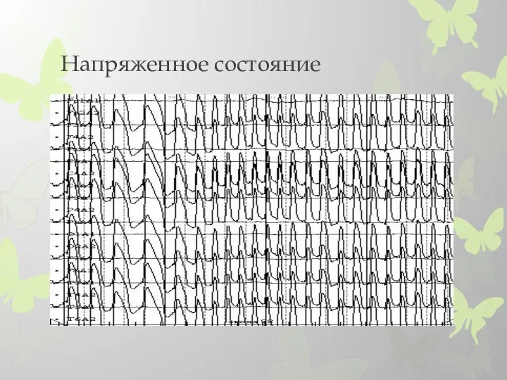 Напряженное состояние