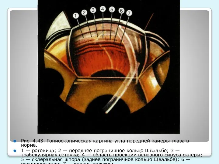 Рис. 4.43. Гониоскопическая картина угла передней камеры глаза в норме. 1