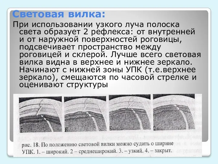 Световая вилка: При использовании узкого луча полоска света образует 2 рефлекса: