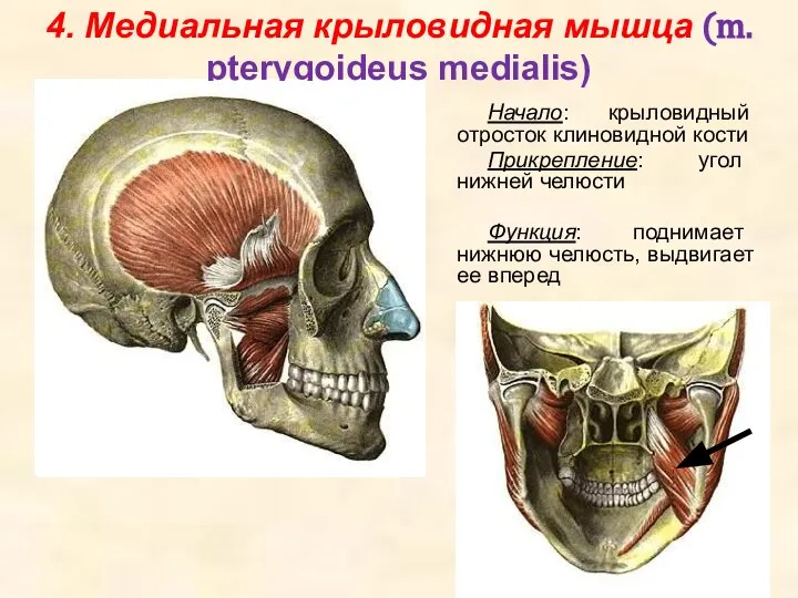 4. Медиальная крыловидная мышца (m. pterygoideus medialis) Начало: крыловидный отросток клиновидной