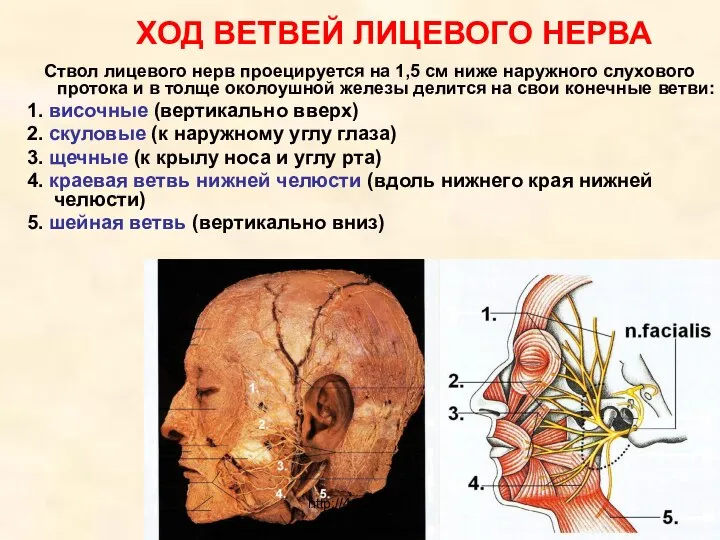 ХОД ВЕТВЕЙ ЛИЦЕВОГО НЕРВА Ствол лицевого нерв проецируется на 1,5 см