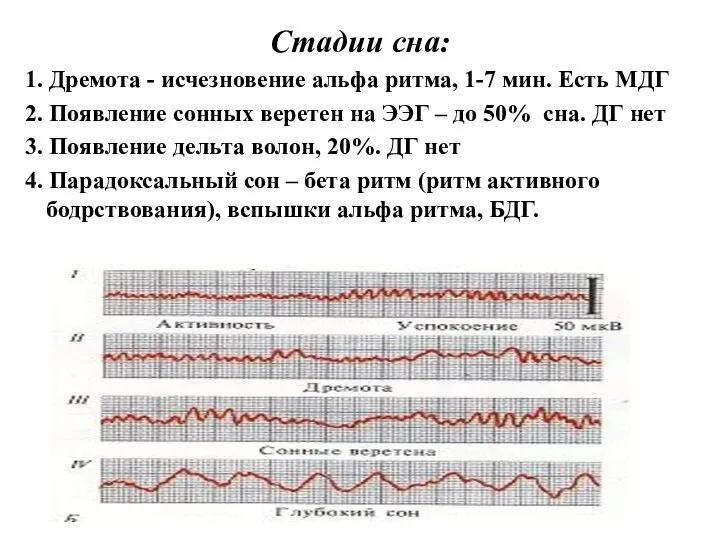 Стадии сна: 1. Дремота - исчезновение альфа ритма, 1-7 мин. Есть