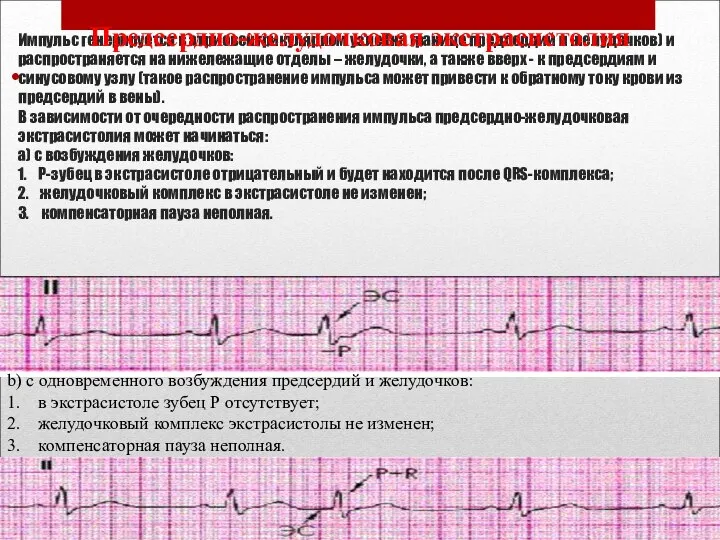 Импульс генерируется в атриовентрикулярном узле (на границе предсердий и желудочков) и