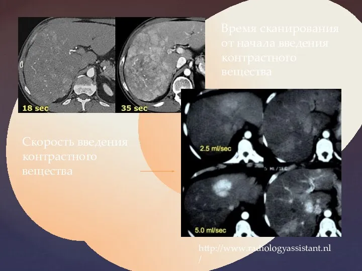 http://www.radiologyassistant.nl/ Время сканирования от начала введения контрастного вещества Скорость введения контрастного вещества