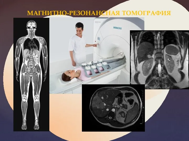 МАГНИТНО-РЕЗОНАНСНАЯ ТОМОГРАФИЯ